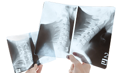 Рентгенография позвоночника с функциональными пробами ( ШОП)(4 проекции)
